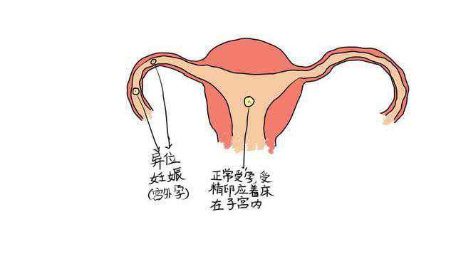 39岁北京试管供卵成功率是多少啊，我的供卵试管婴儿经历